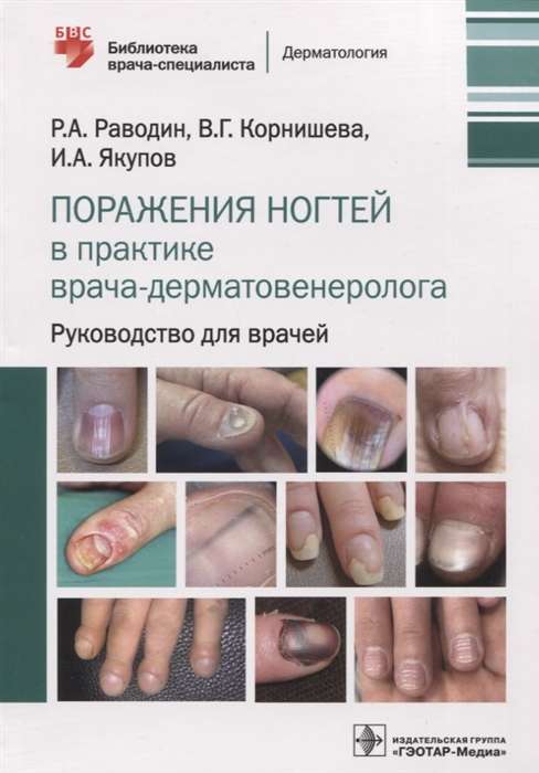 Поражения ногтей в практике врача-дерматовенеролога.Руководство для врачей