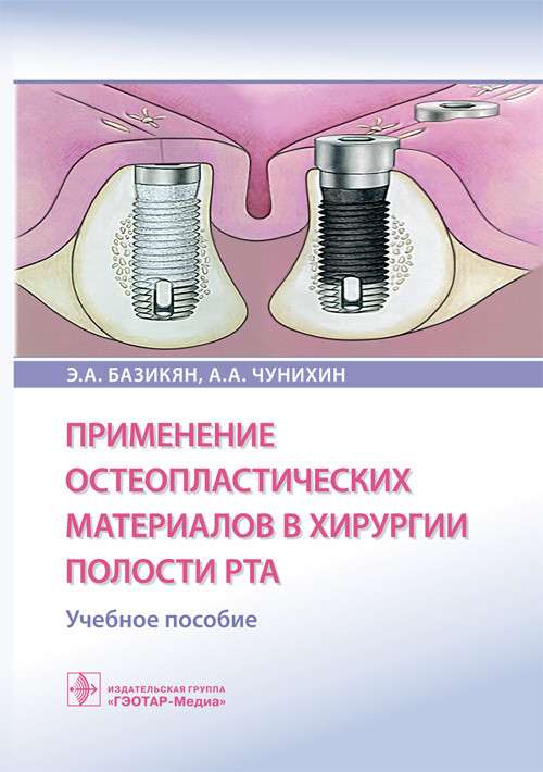 Применение остеопластических материалов в хирургии полости рта